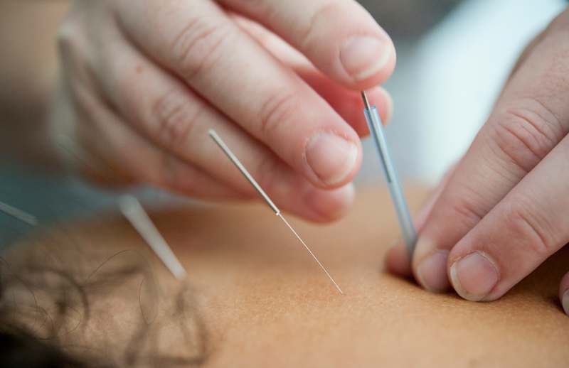 Illustration of acupuncture needles near meridian points on a human silhouette with subtle green wellness motifs