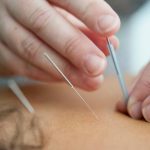 Slim Needles Before and After: 7 Proven Ways to Avoid Painful Weight Loss Mistakes